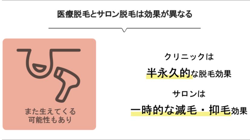 光(美容)脱毛から医療脱毛乗り換えたあとの効果は？