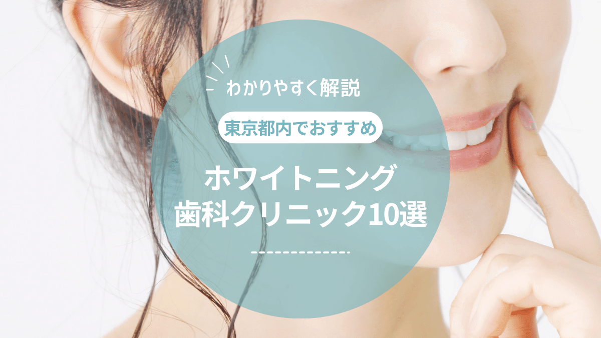 【2024年最新】東京都内でホワイトニングがおすすめの歯科クリニック10選