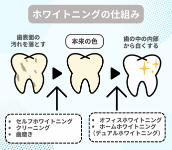 ホワイトニングとは