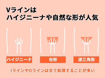 メンズVIO脱毛のデザイン・形って？全剃りってどうなの？