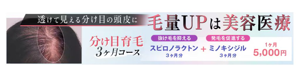 湘南美容クリニックのFAGA治療