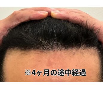カミノクリニック施術後