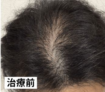 B&Hメディカルクリニック治療前