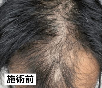 クリニックフォア治療前