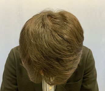 施術後