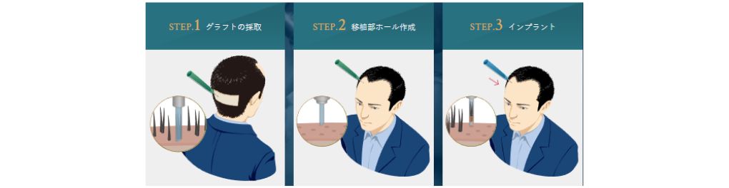 i-Direct