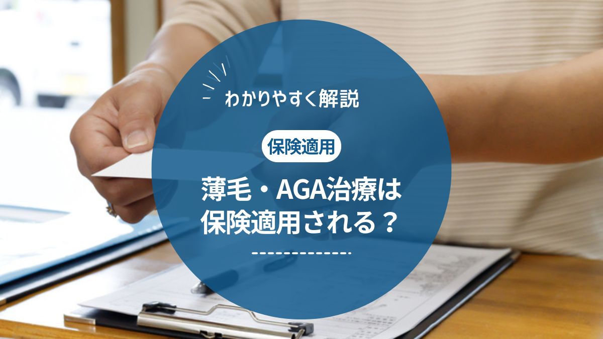 AGA治療は保険適用される？例外ケースや安く治療するおすすめの方法を紹介