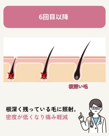 6回目以降:残った毛の仕上げ