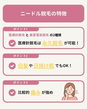 ニードル脱毛の特徴