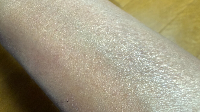 腕脱毛を4回受けた腕