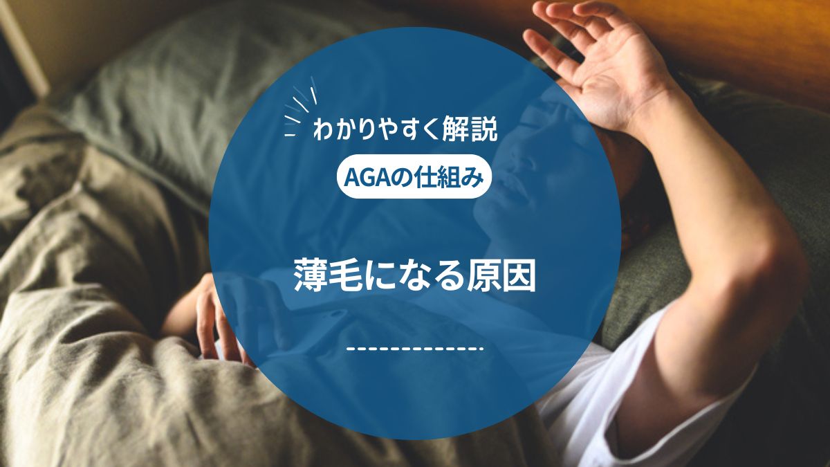 AGAの原因とセルフチェック項目！治療アプローチ・対策を解説