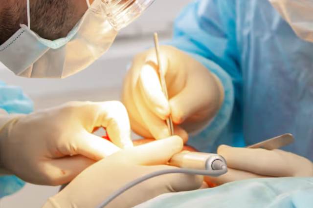 カミノクリニックの自毛植毛の治療の流れ