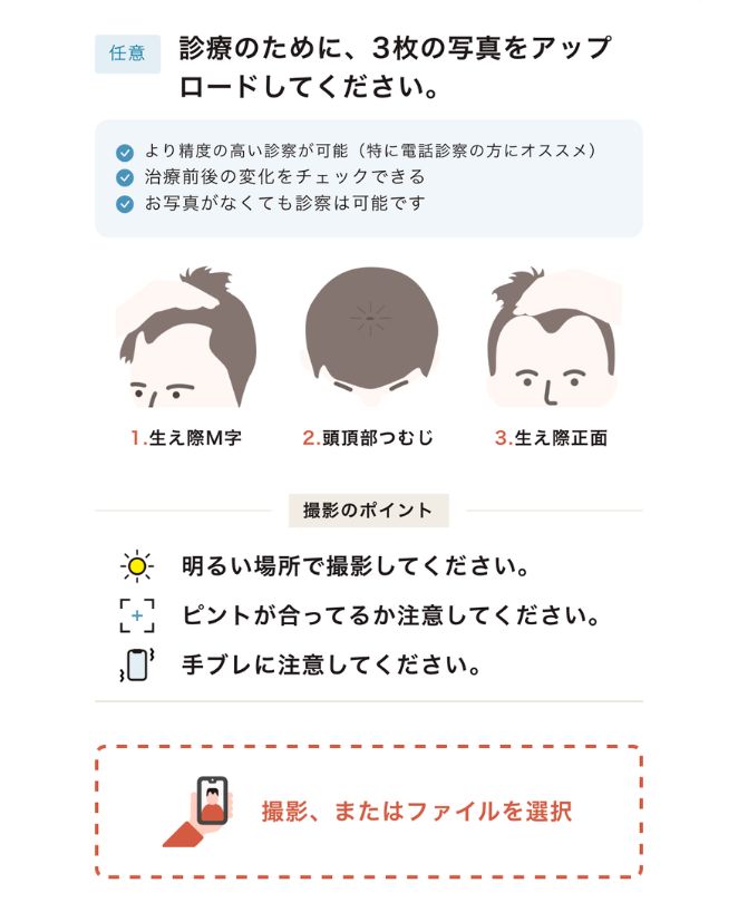 事前問診は頭皮を撮影し提出する