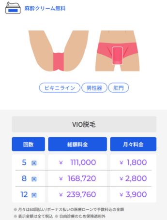 VIO脱毛の料金プラン